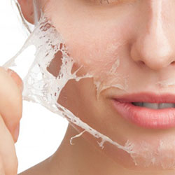 peeling quimico copiar